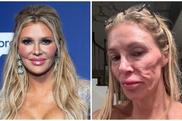 Real Housewives' Star Shares Shock Diagnosis for Facial Disfigurement
