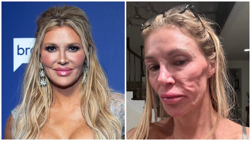 Real Housewives' Star Shares Shock Diagnosis for Facial Disfigurement