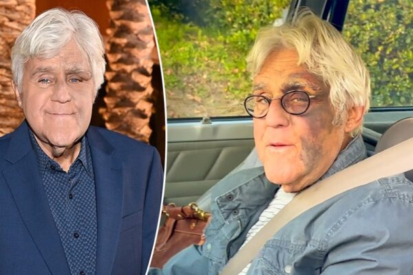 Jay Leno addresses rumors his facial injuries were related to mob retaliation