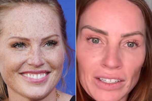 Side-By-Side Pics Of Mina Starsiak Hawk Highlight Her Rumored Plastic Surgery