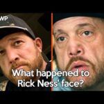 What happened to “Gold Rush” star Rick Ness' face? - YouTube